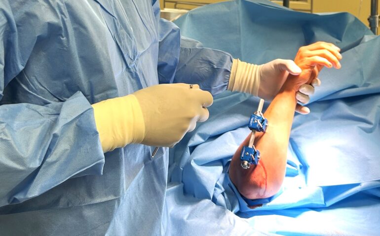 wydłużanie kości Szpital Pediatryczny Bielsko-Biała