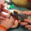 Obrączka utknęła na spuchniętym palcu. Do akcji w Szpitalu Śląskim wezwano strażaków